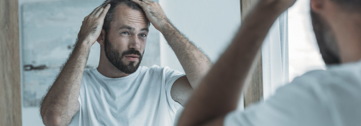 La pelade : chute de cheveux en plaques