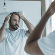 La pelade : chute de cheveux en plaques