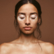 Symptômes, diagnostic et traitement du vitiligo
