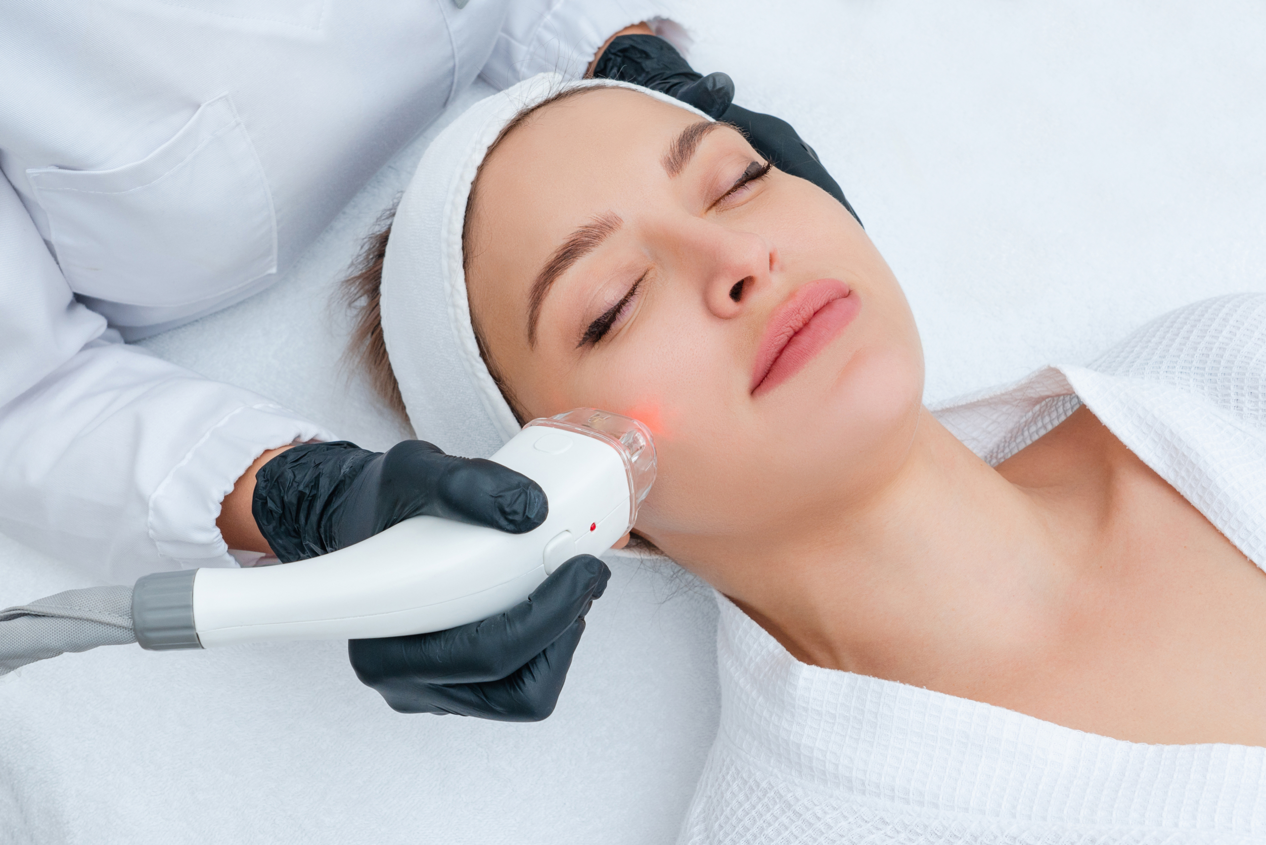 Résultats après traitement du visage au laser