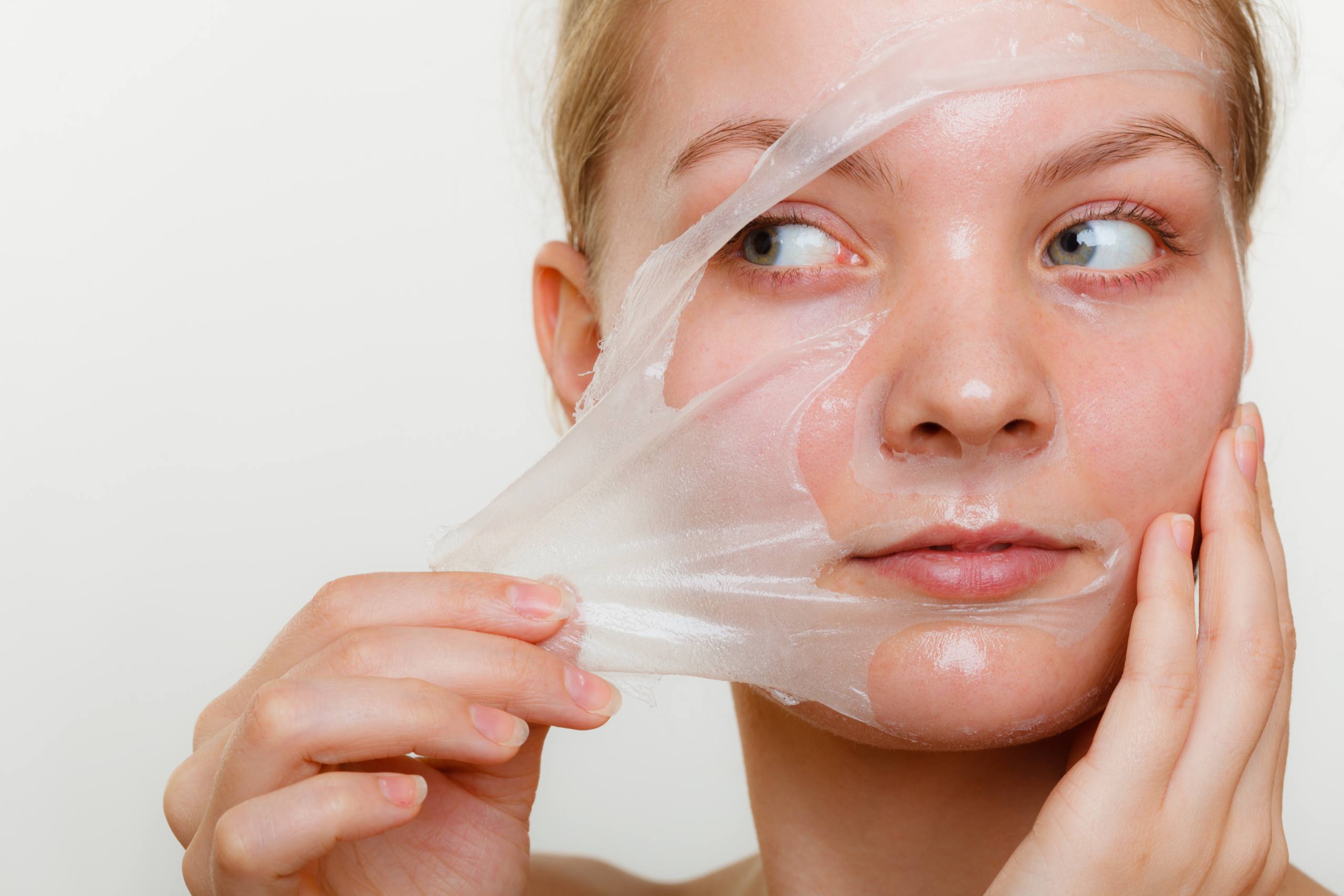 Résultats après un peeling chimique