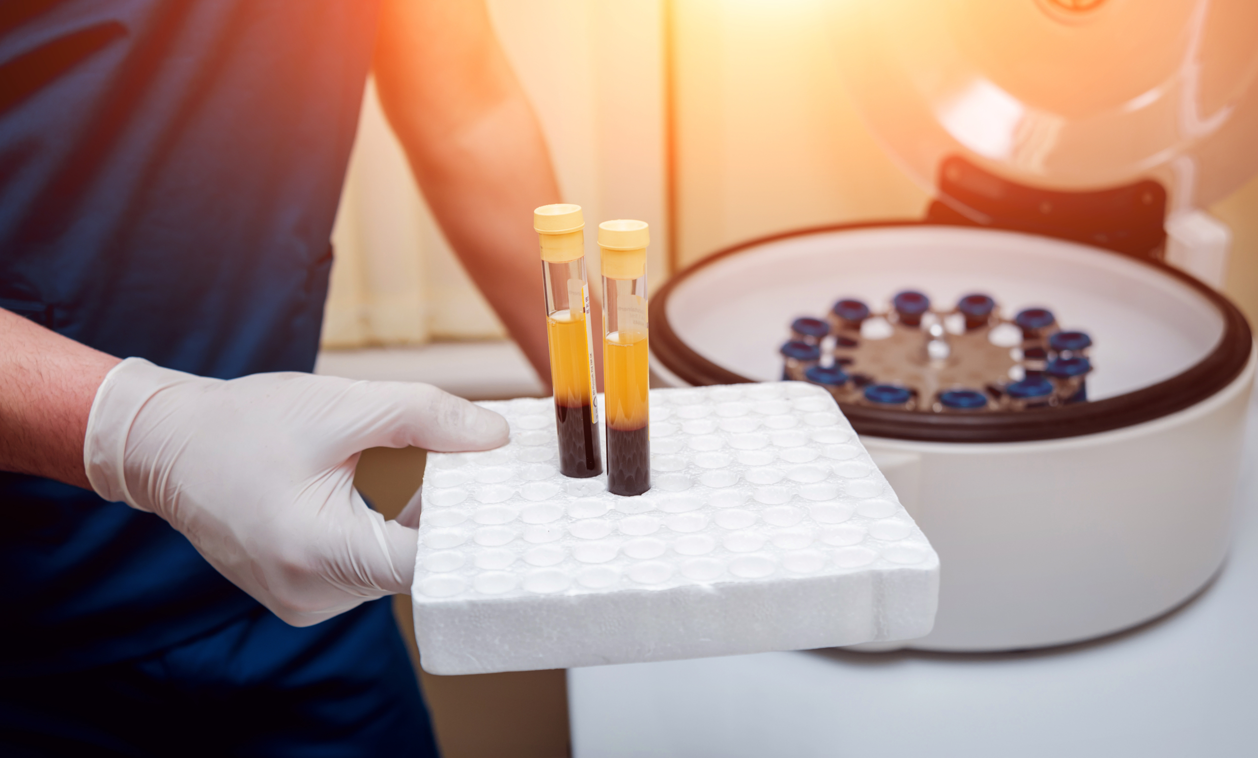 fonctionnement-traitement-prp